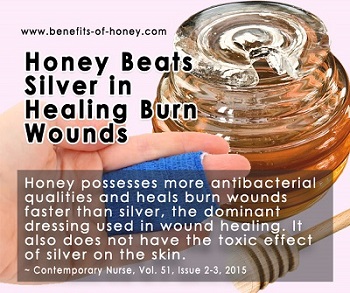 honey as burn treatment image